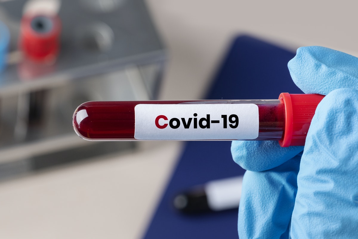Hungarian Gov't Officials Test Negative For Coronavirus