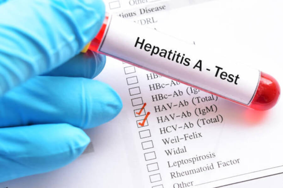 Health Authority Warns of Rise in Hepatitis A Cases in Hungary