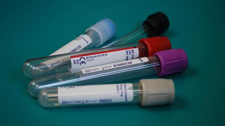 Hungary Plans To Expand Testing For Hepatitis C