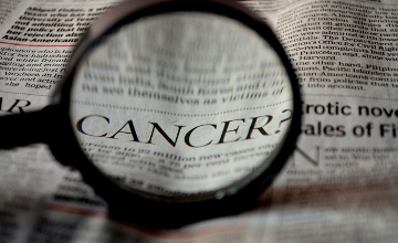 Cancer Breakthrough in Hungary Identifies Switch to Inhibit Tumour Growth Cancer Breakthrough in Hungary Identifies Switch to Inhibit Tumour Growth